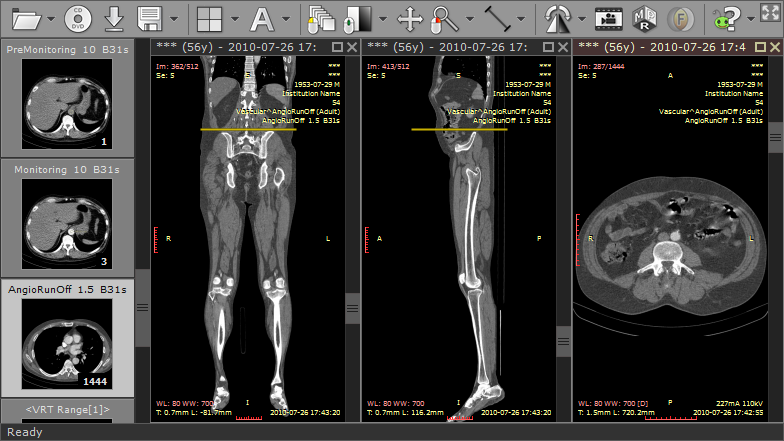 radiant_dicom_viewer